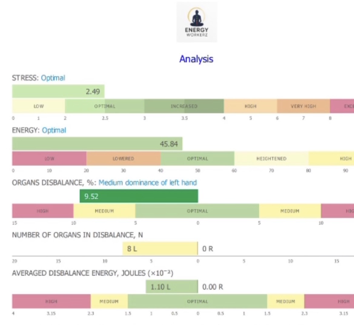 Stress-level visualization shared only as non-clinical wellness information.